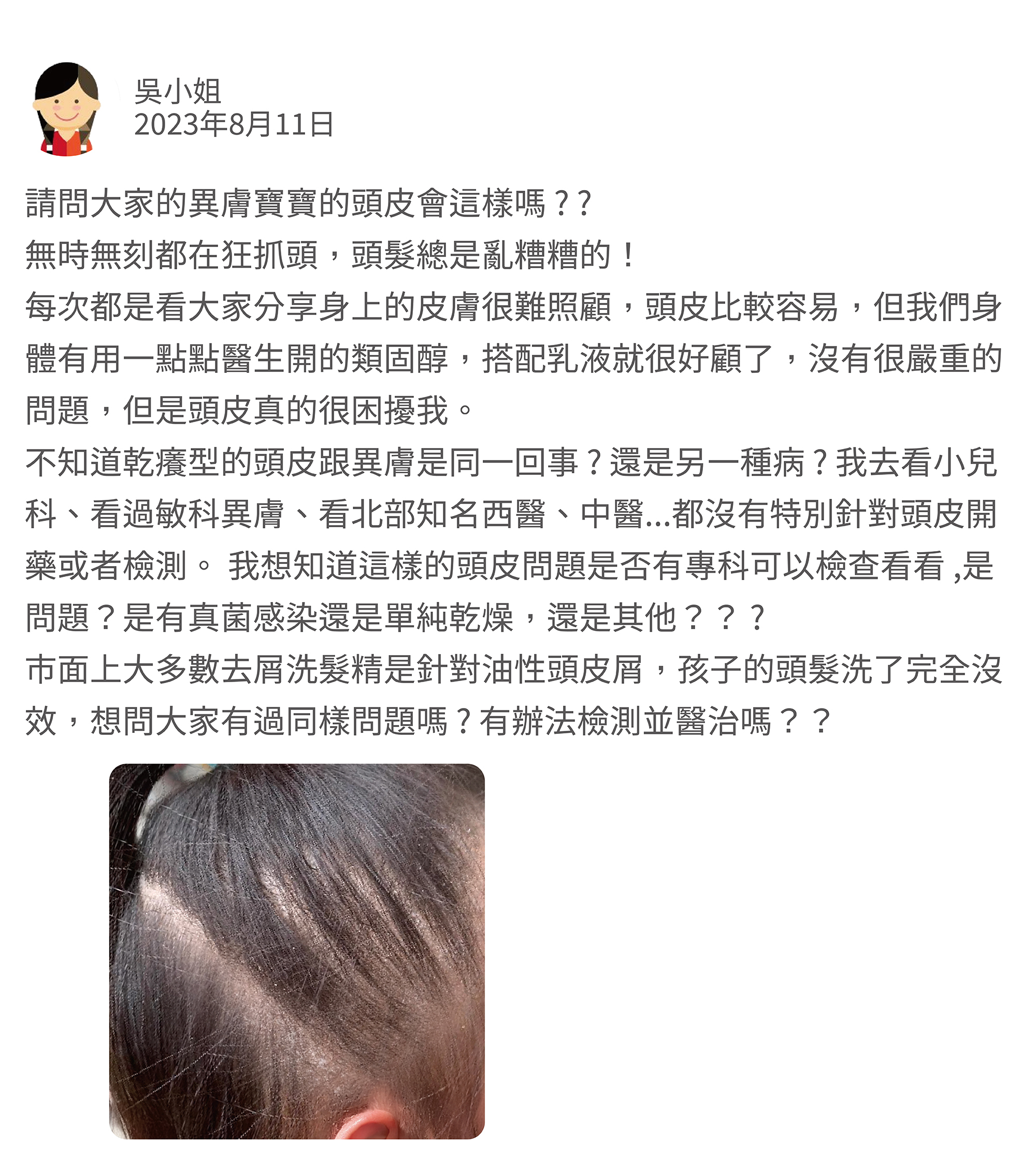 Q:請問你們異膚寶寶的頭皮會這樣嗎？？每天都在狂抓狂抓，頭髮永遠亂糟糟的。原本我以為異膚寶寶頭皮都是很難顧，但是看大家分享好像很多人也是身體皮膚有問題，頭皮好像還好。而我們身體其實用一點點類固醇搭配乳液，很好顧，也不會有很嚴重的問題了。只是頭皮這真的很困擾。不知道頭皮這樣乾癢型的是跟異膚是同一回事，還是另一種病？？我去看小兒科，看過敏科，看異膚，看新光王，看中醫胤，都沒有去特別針對頭皮開藥或者檢測過，我想知道這樣的頭皮問題是否有專科可以檢查看看，是什麼問題？是有真菌感染還是單純乾燥，還是…..有什麼問題嗎？？市面上大多數去屑洗髮水，都是針對油性頭皮屑，跟他這種完全沒效。大家有遇過同樣問題嗎？有辦法檢測並醫治嗎？