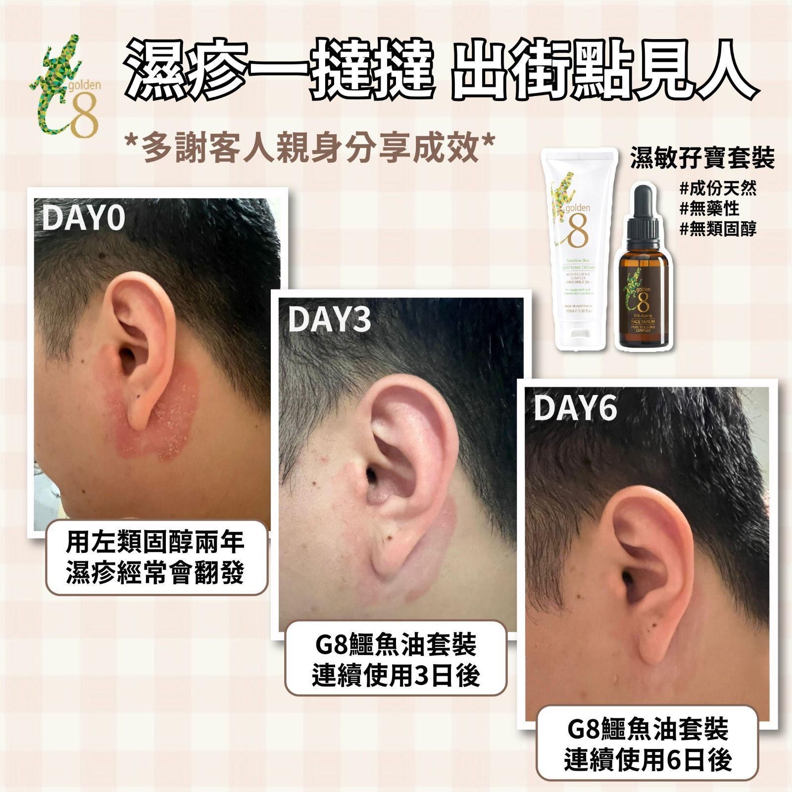 奇蹟修復炎症肌】  敏感發紅、肌膚缺水乾燥