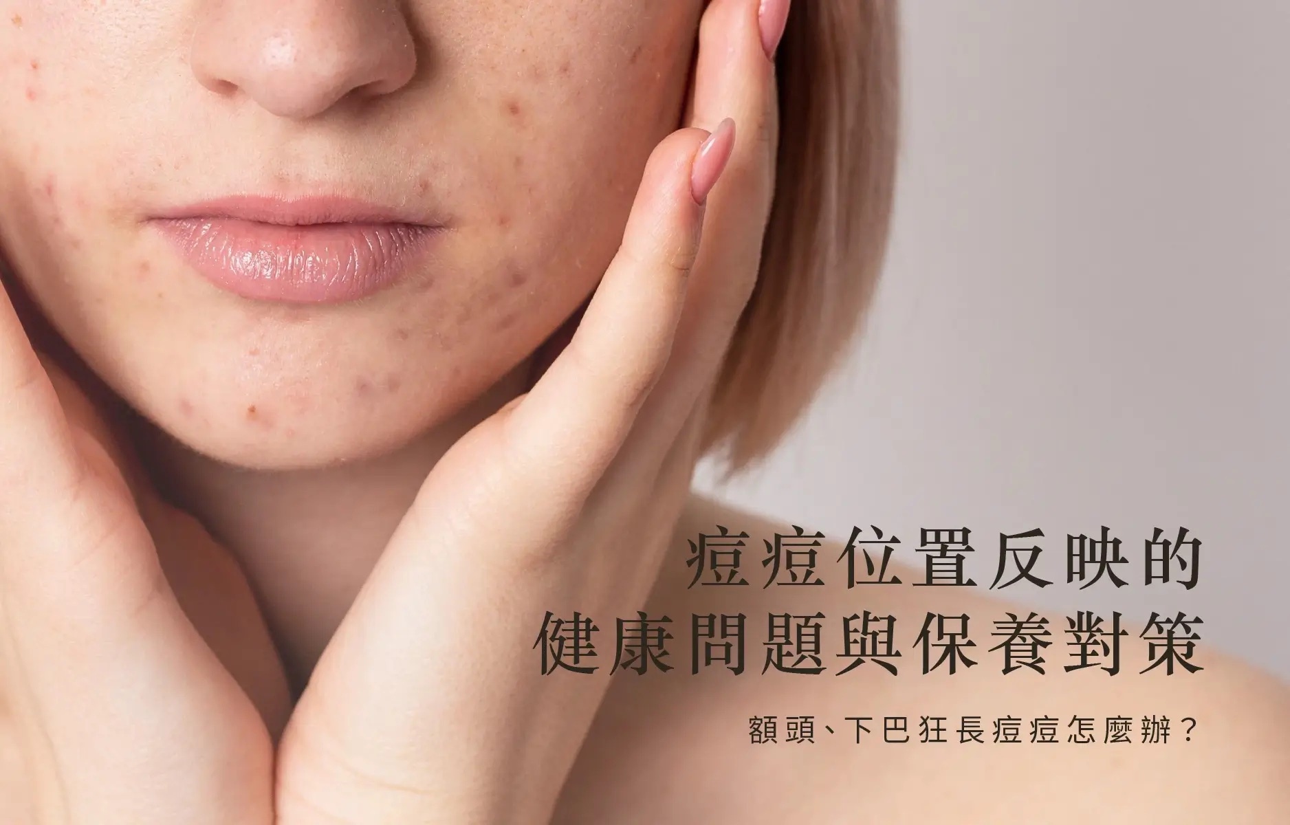 痘痘位置反應健康問題