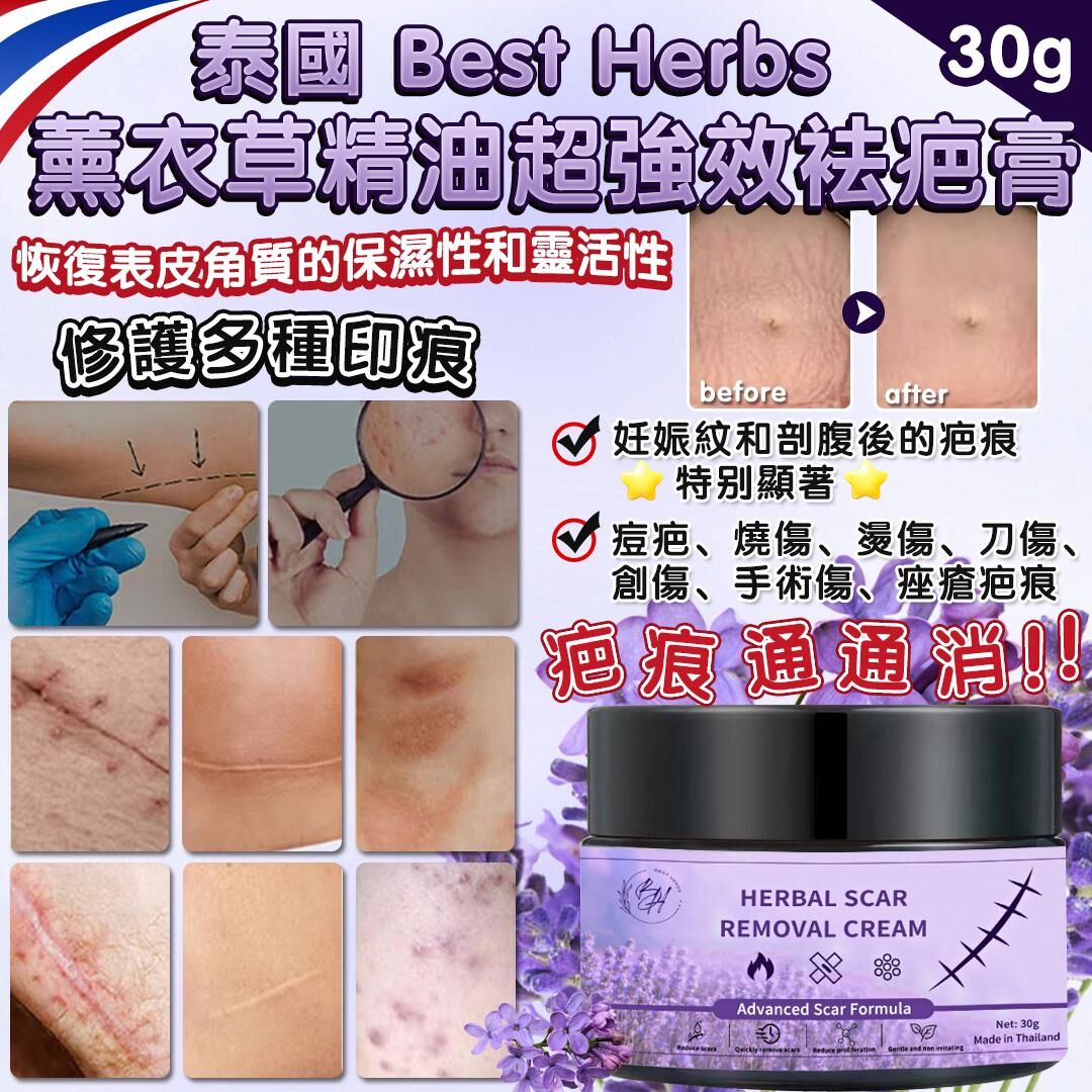 泰國 Best Herbs 薰衣草精油超強效袪疤膏