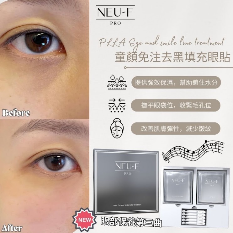(3951)【送贈品】Neu-F Pro 法國 PLLA Eye and Smile Line Treatment 童顏免注去黑填充眼貼套裝