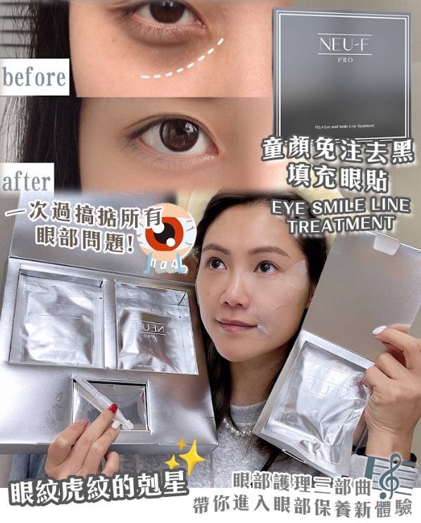 (3951)【送贈品】Neu-F Pro 法國 PLLA Eye and Smile Line Treatment 童顏免注去黑填充眼貼套裝