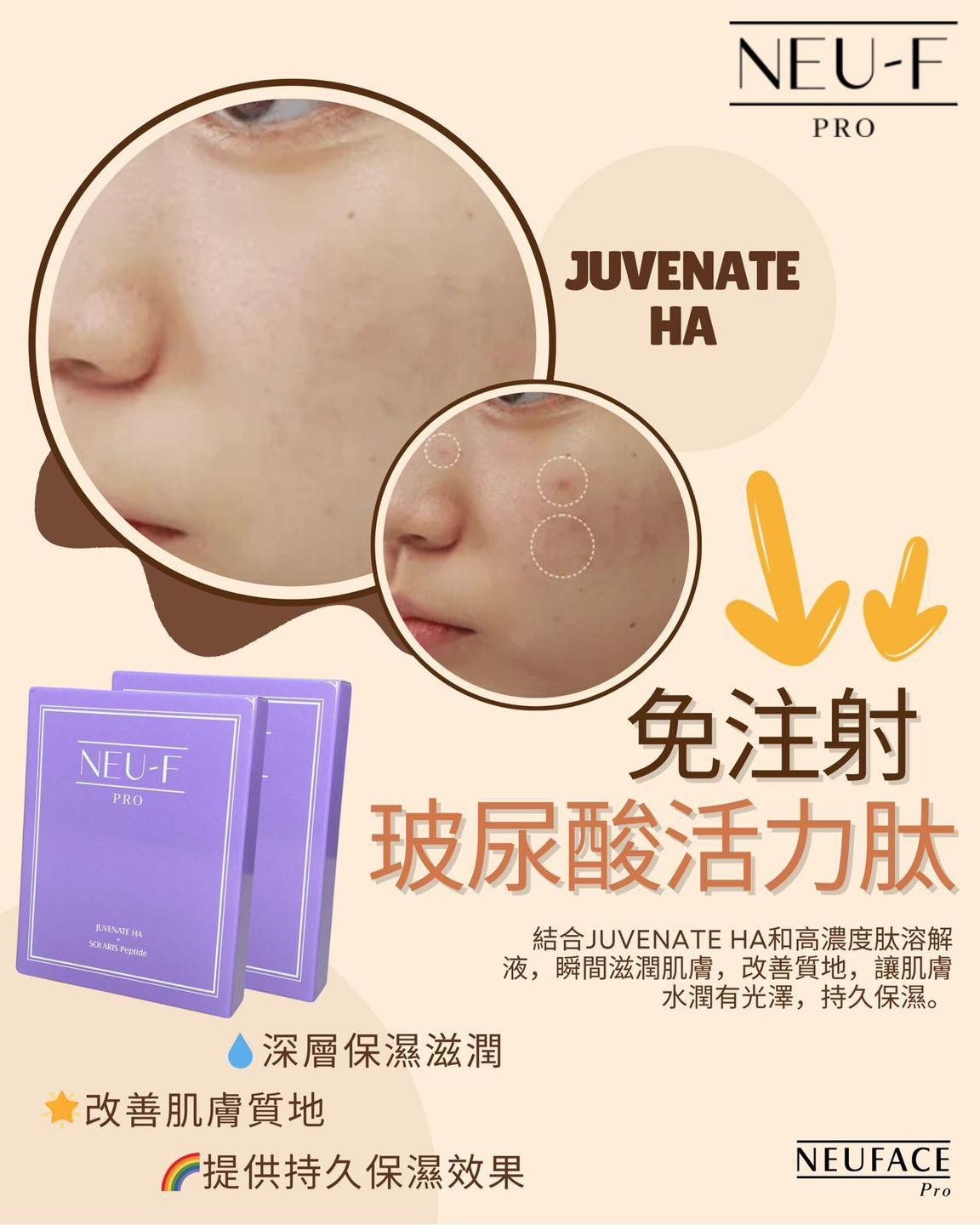 (3628)【買1送1】Neu-f Pro JUVENATE HA免注射玻尿酸活力肽Juvenate HA送隨機面膜5片