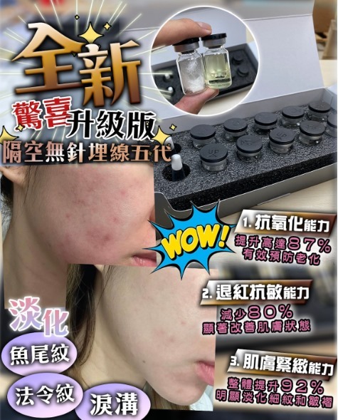 (3621) 全新第五代 NEUFACE Pro DERMTHREAD+ 隔空無針埋線 x1【送Neuface Gift面膜 8 片】