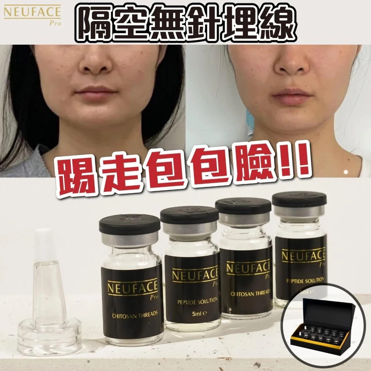 (3621) 全新第五代 NEUFACE Pro DERMTHREAD+ 隔空無針埋線 x1【送Neuface Gift面膜 8 片】