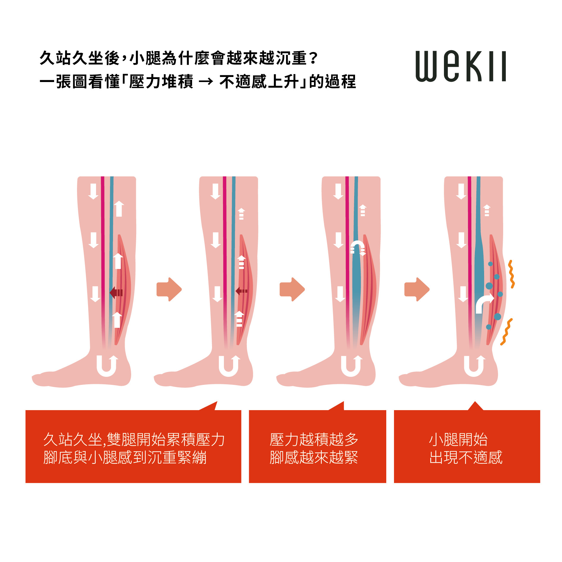 小腿感覺悶脹的示意流程圖，顯示腳部壓力堆積過程