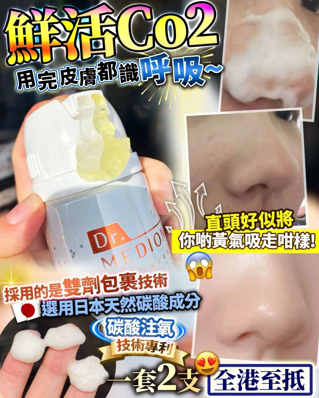 (2支)鮮活Co2 R581（1-2 星期寄出）