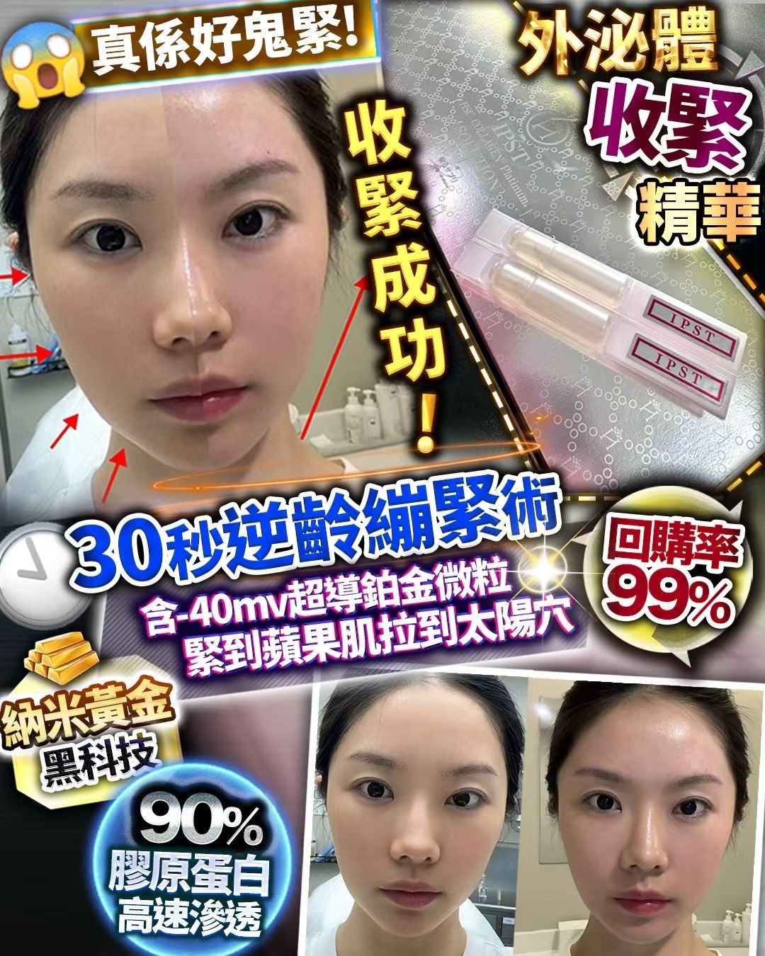 🔥日本 外泌體收緊精華 一盒30支