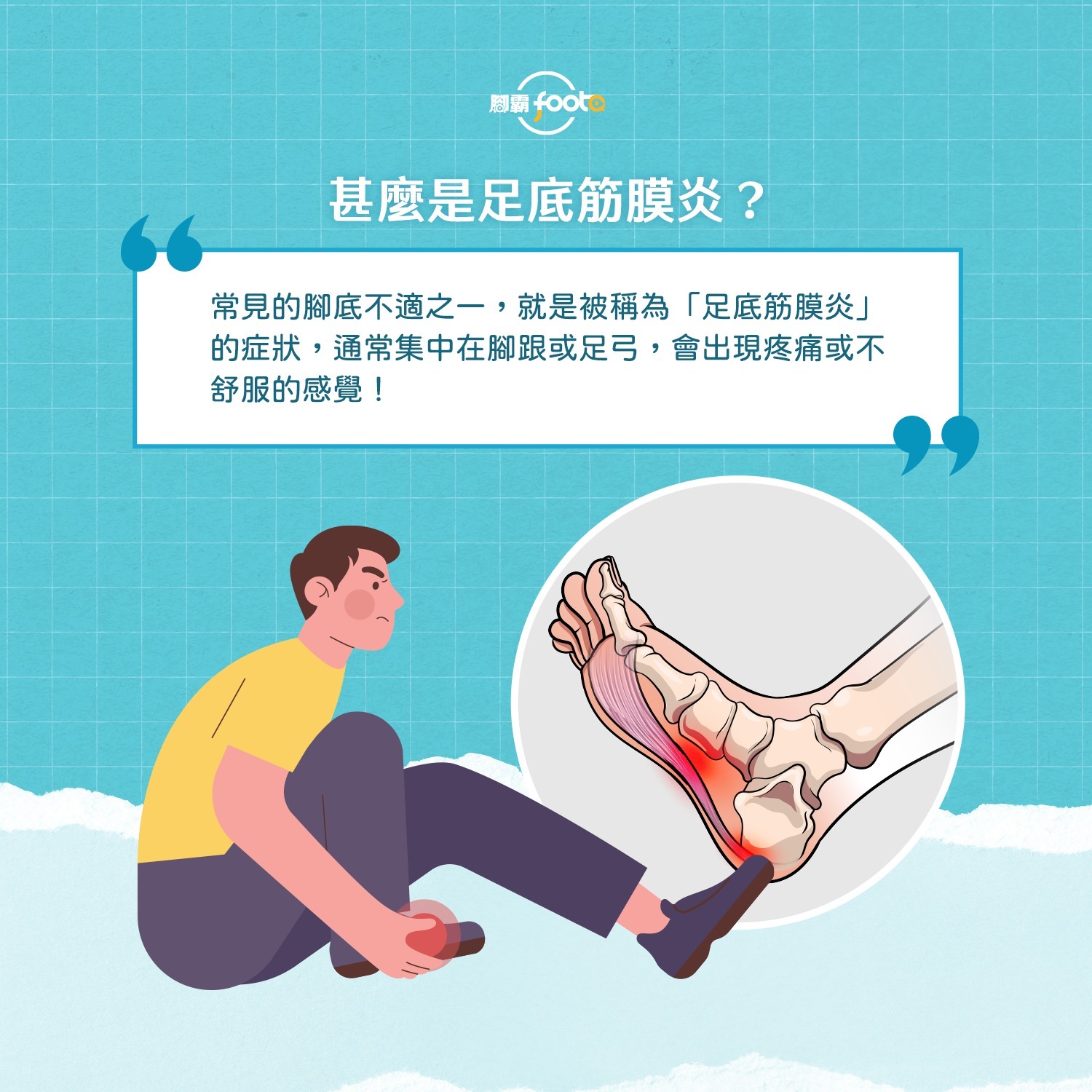 足底筋膜炎