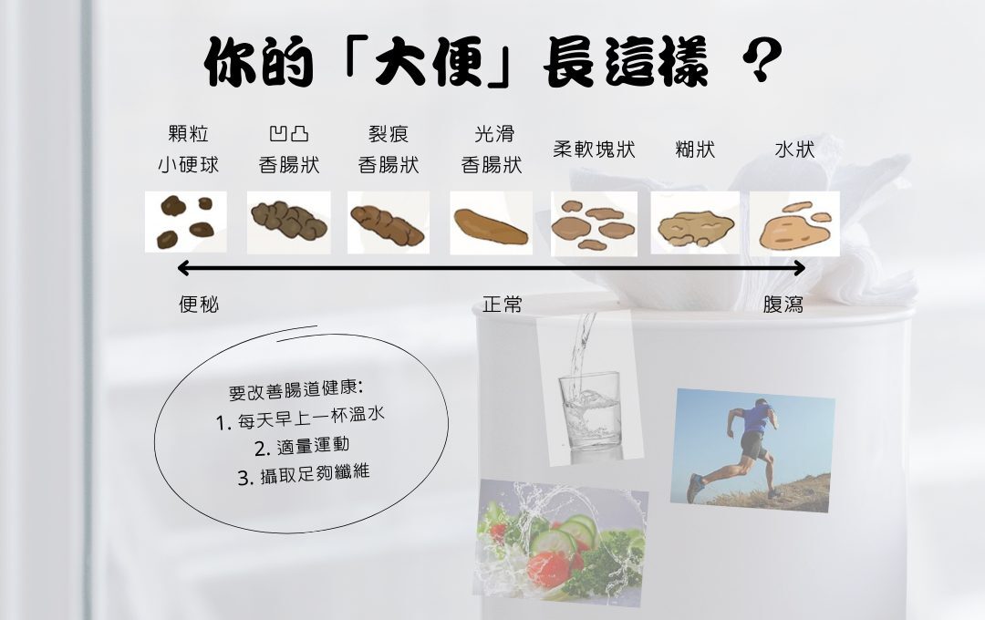大便形狀反映身體狀況
