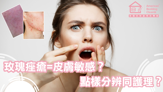 玫瑰痤疮与皮肤敏感对比图片