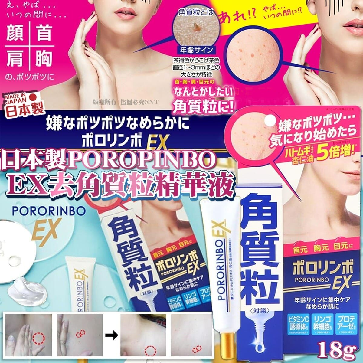 【預訂】AQ081603 日本製 POROPINBO EX 去角質粒精華液 18g