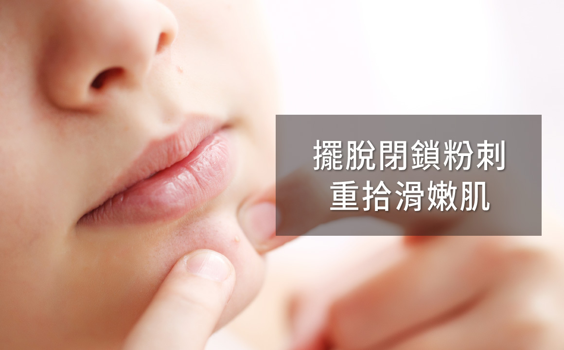 臉上小疙瘩閉鎖性粉刺保養建議，擺脫內包粉刺重拾光滑膚質