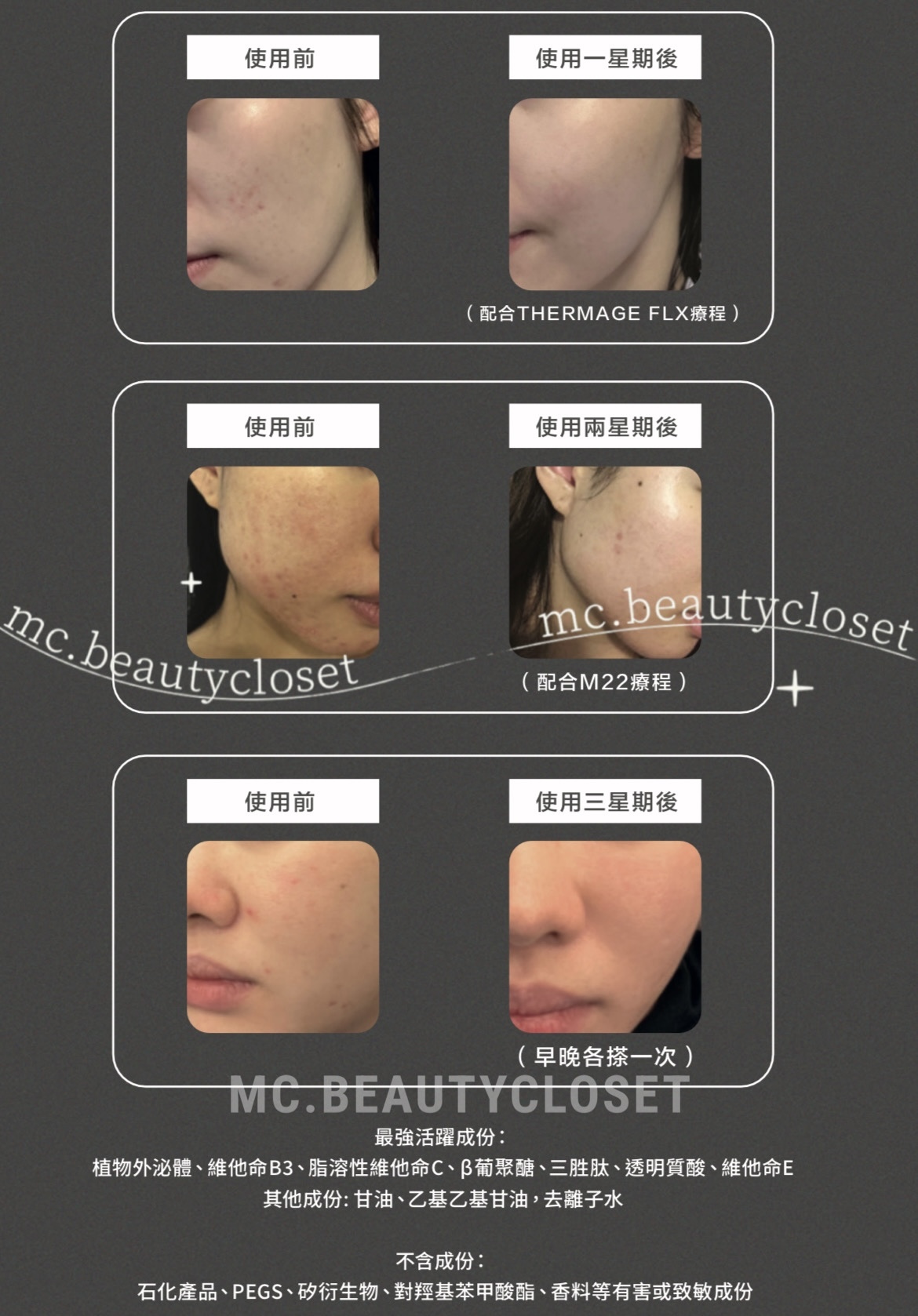 B.Y.O.B EXO-BCE 外泌體奇蹟再生精華 5ml x 5支