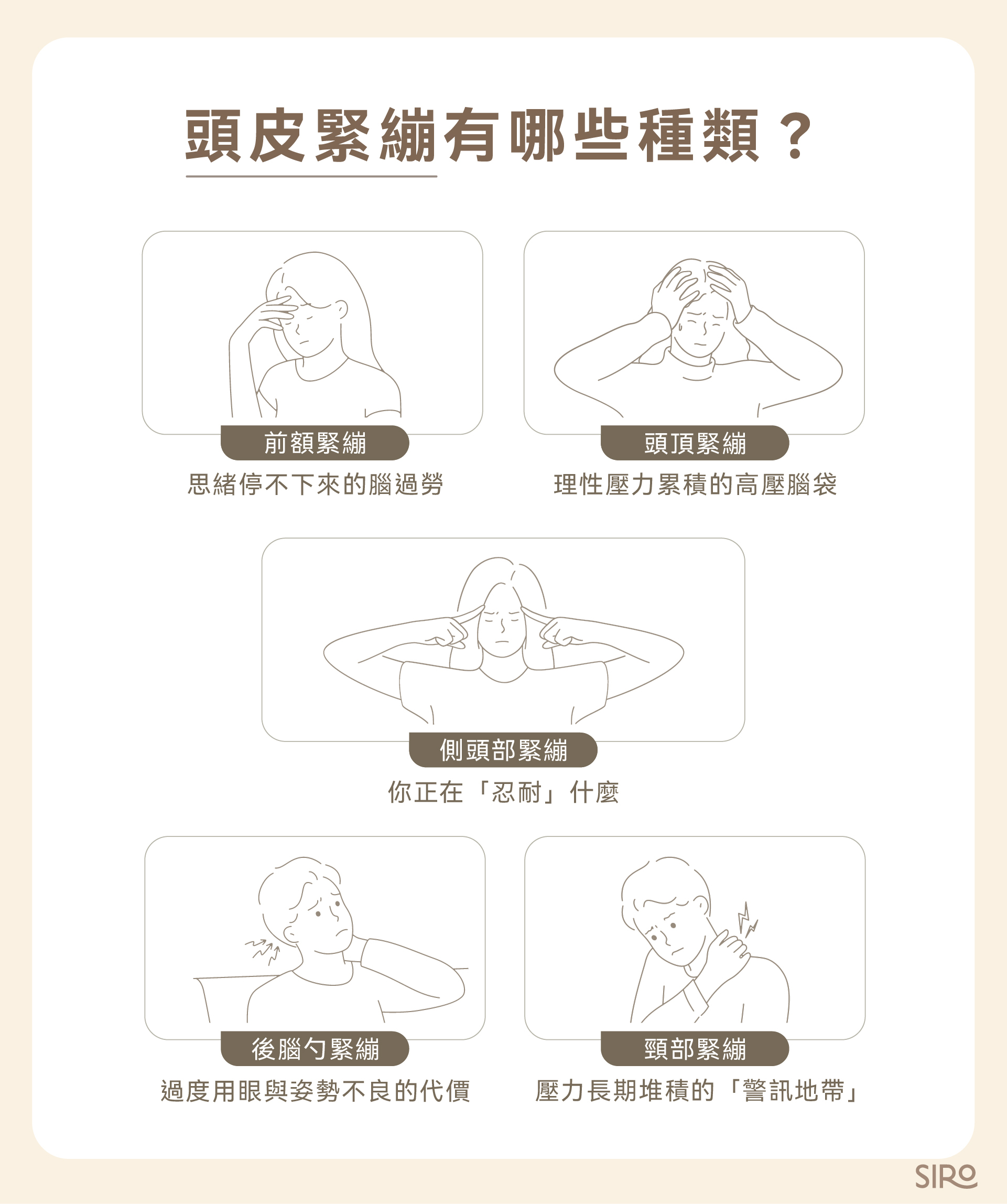 頭皮緊繃種類分成：前額緊繃、頭頂緊繃、側頭部緊繃、後腦杓緊繃、頸部緊繃