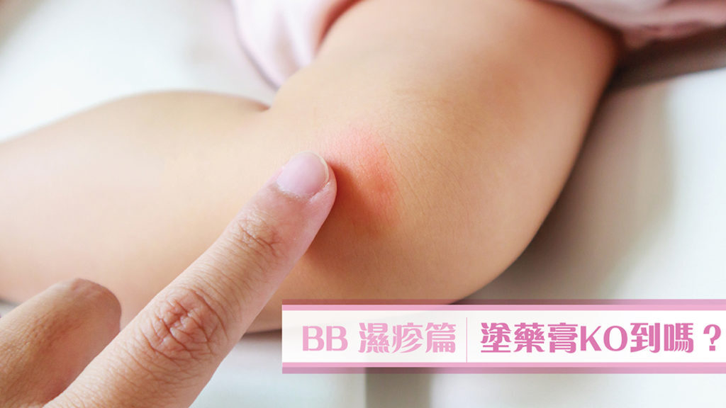 bb有濕疹！塗咩藥膏好？