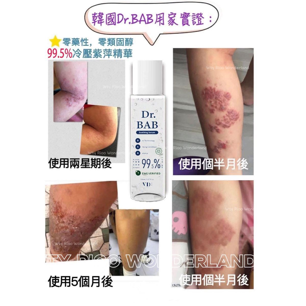 W0403 DR BAB Soothing Serum 升級+增量限量版150ml