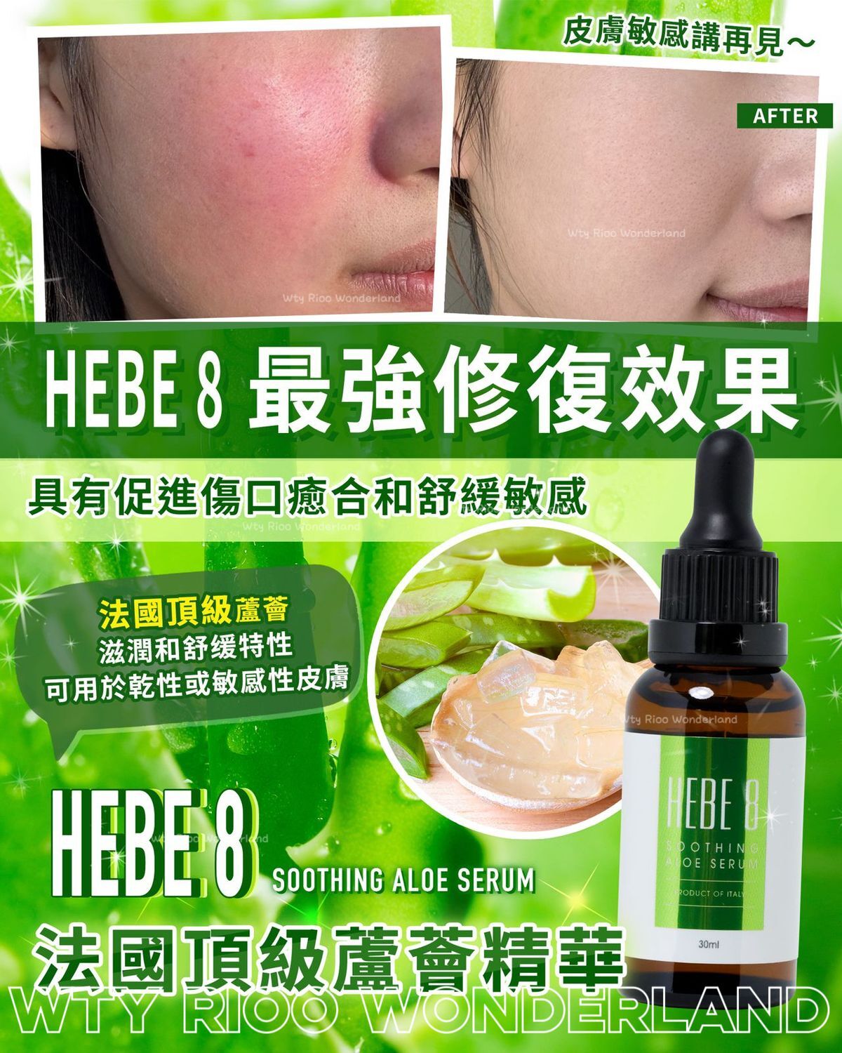 W041401HEBE8法國頂級蘆薈精華30ml