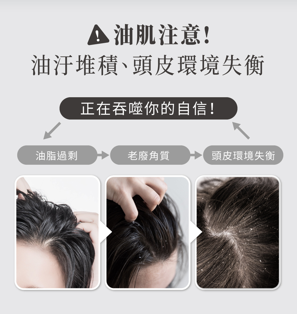 油肌注意 小心頭皮環境失衡