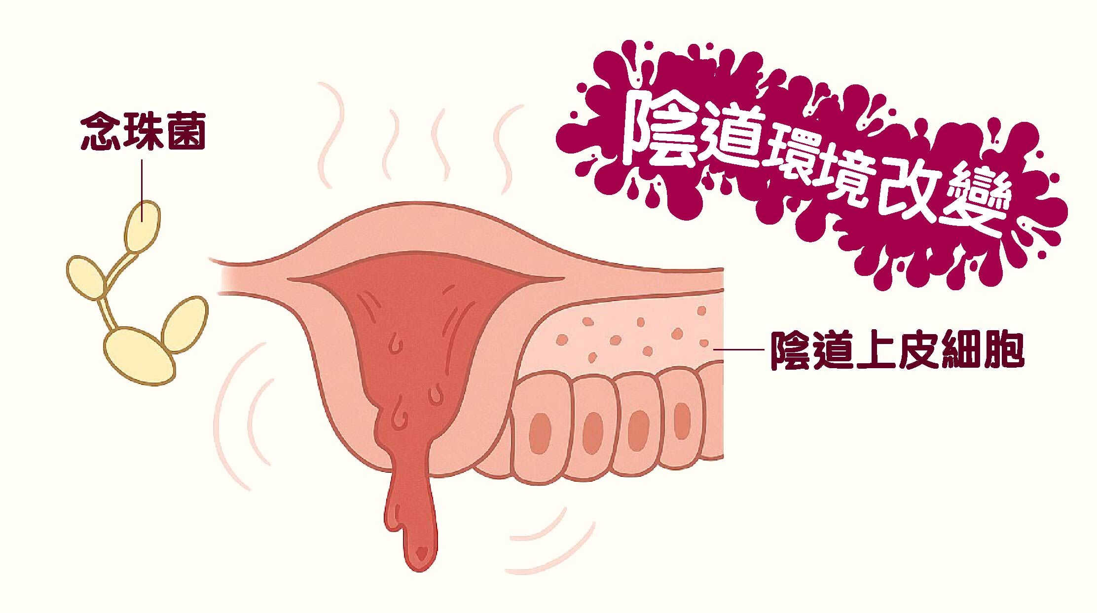 陰道環境改變:  月經期間，經血的滲出使得陰道周圍環境變得溫暖潮濕，這正是念珠菌理想的生長環境。