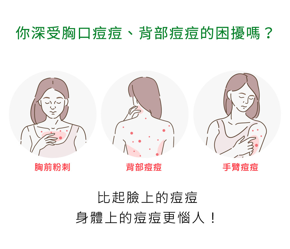 NARUKO 牛爾 茶樹神奇抗痘美背噴霧 100ml