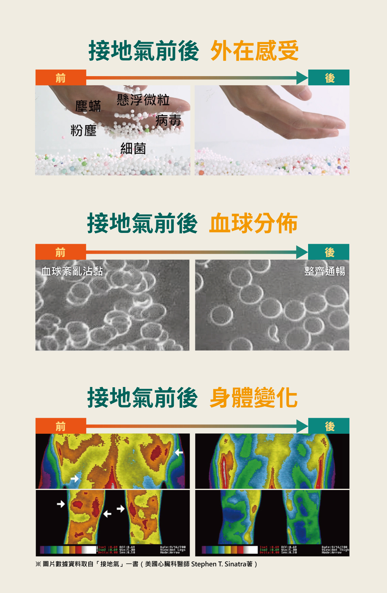 USTINI 我挺你健康鞋 排靜電前後身體對比