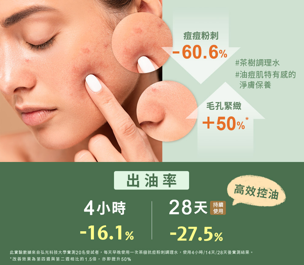 NARUKO 牛爾 茶樹抗痘粉刺調理水150ml