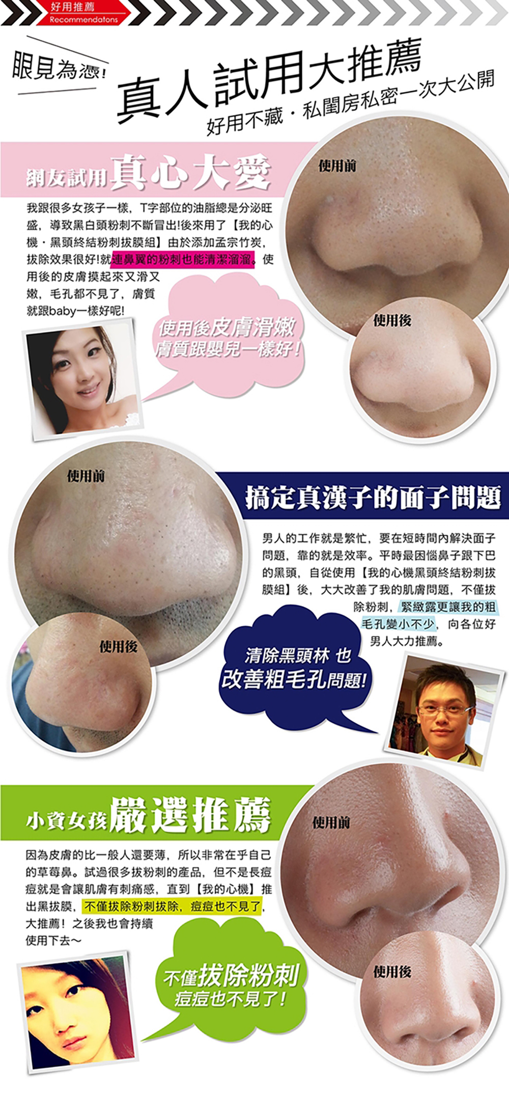 我的心機 黑頭終結粉刺拔膜組 升級版