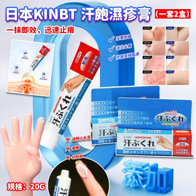 日本 KINBT 汗皰濕疹膏 (1套2支)