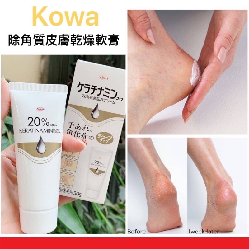 (預購商品 9/5收單) Kowa除角質層皮膚乾燥軟膏 30g