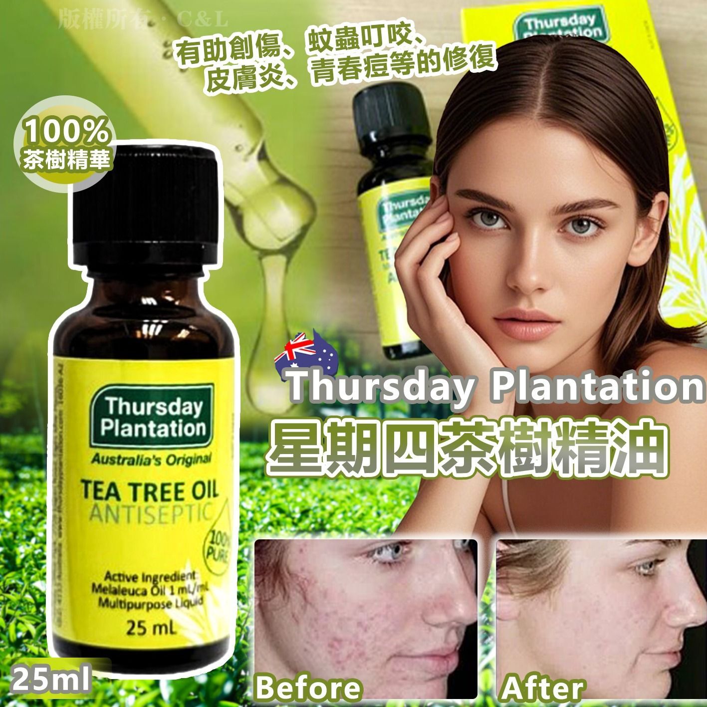 澳洲 Thursday Plantation 星期四茶樹精油25ml