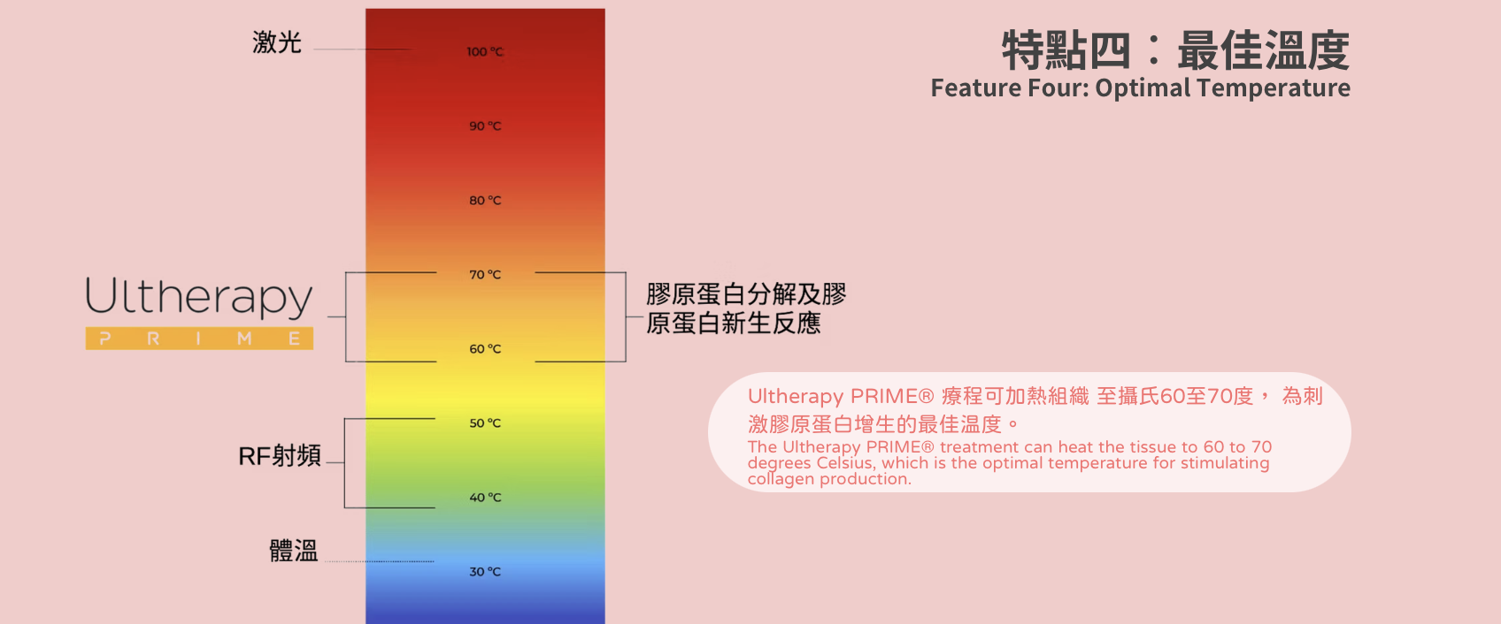 Ultherapy Prime 第二代超聲刀 美版HIFU 最佳溫度