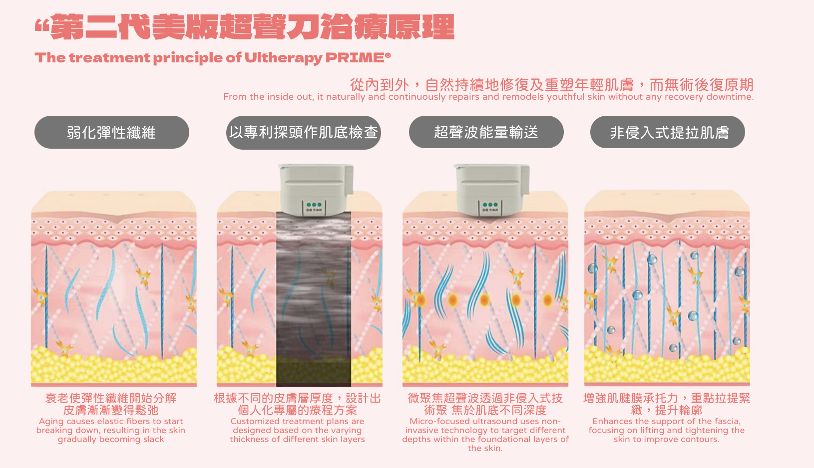 Ultherapy Prime 第二代超聲刀 美版HIFU