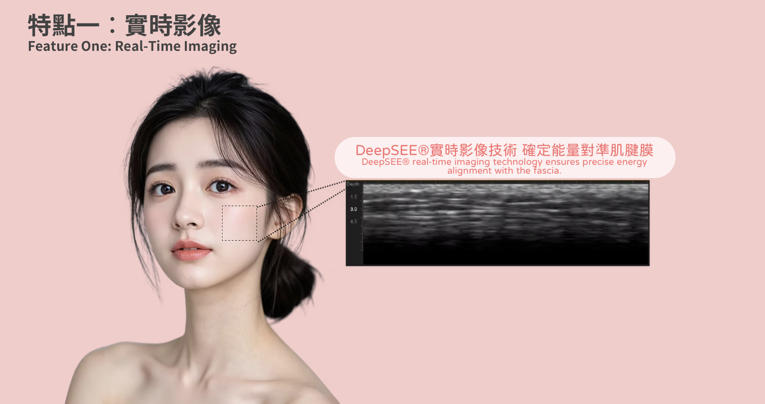 Ultherapy Prime 第二代超聲刀 美版HIFU