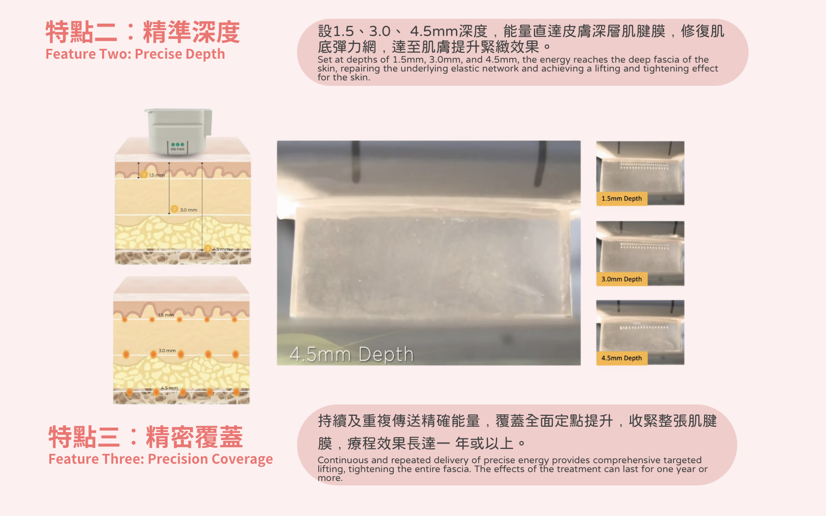 Ultherapy Prime 第二代超聲刀 美版HIFU