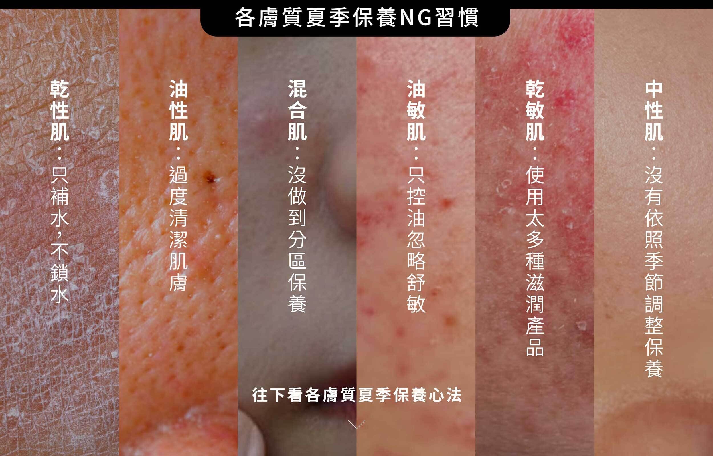 各膚質夏季NG習慣