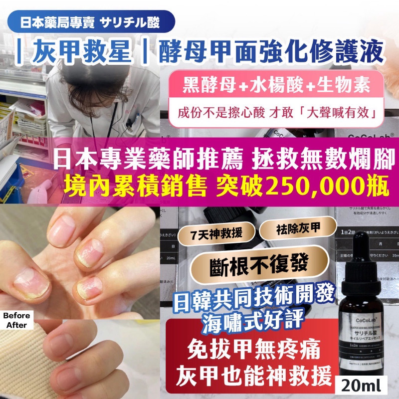 日本藥局專賣サリチル酸灰甲救星酵母甲面強化修護液20ml