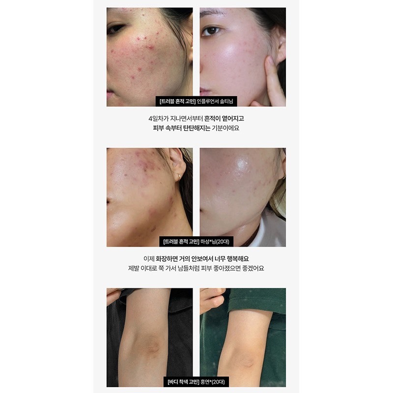 🇰🇷Meditherapy抗老修護A醛精華150ml