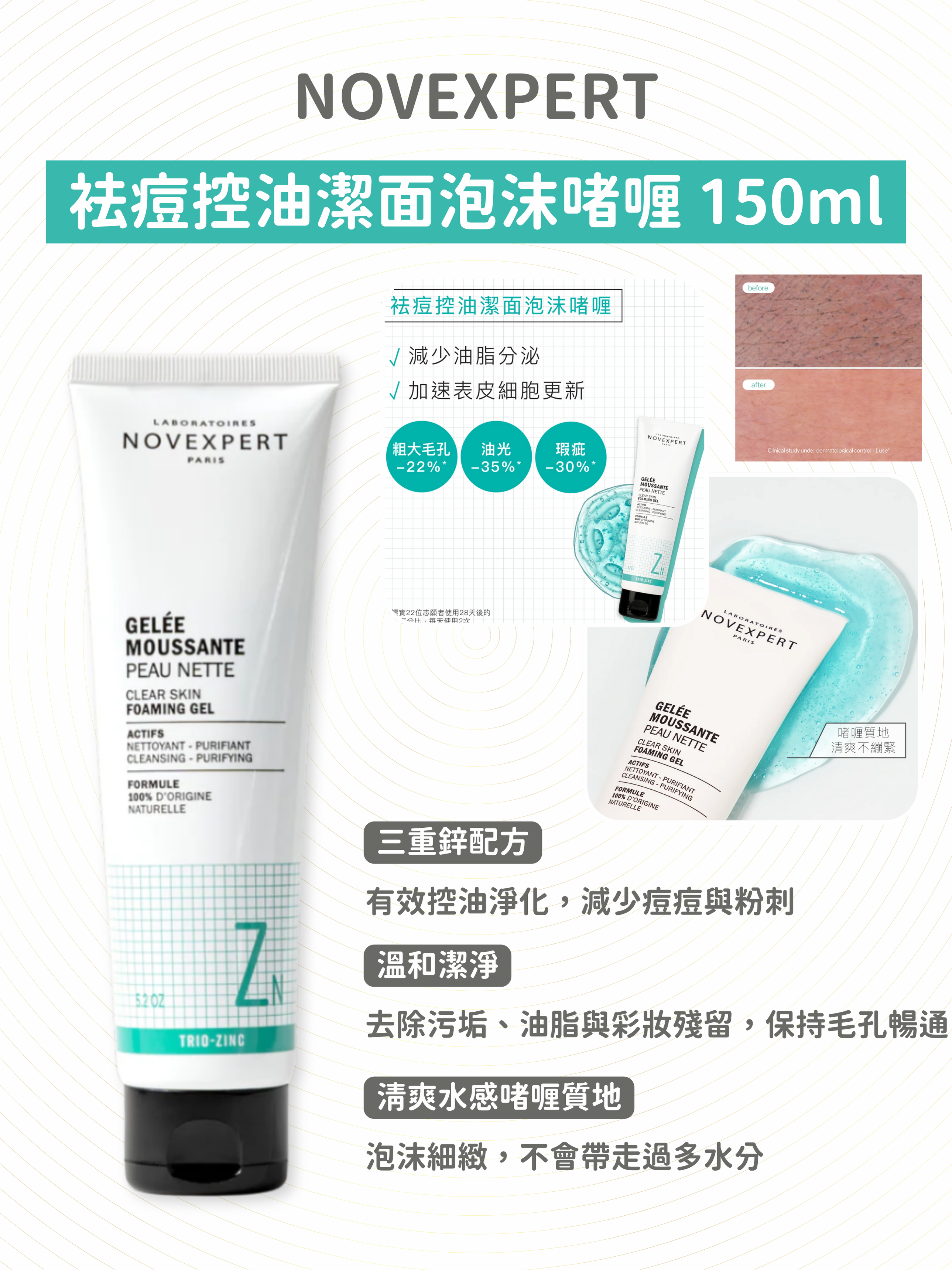 Novexpert - 袪痘控油潔面泡沫啫喱 150ml