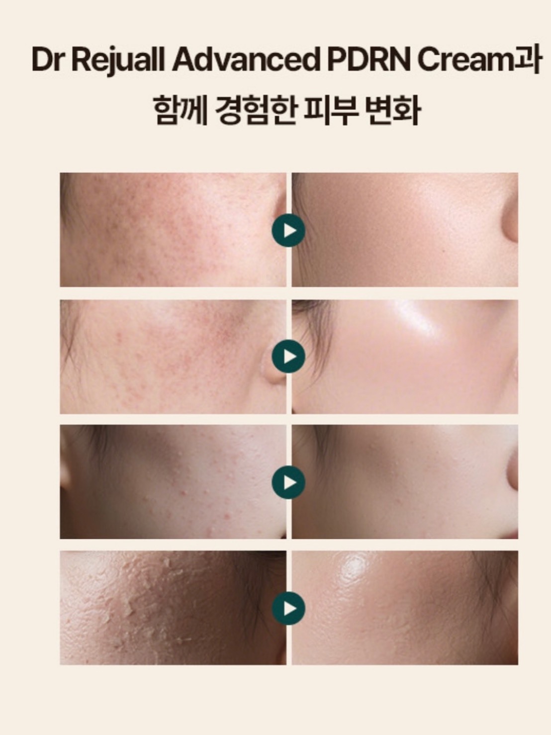 REJUALL ADVANCED PDRN 修護霜 20G