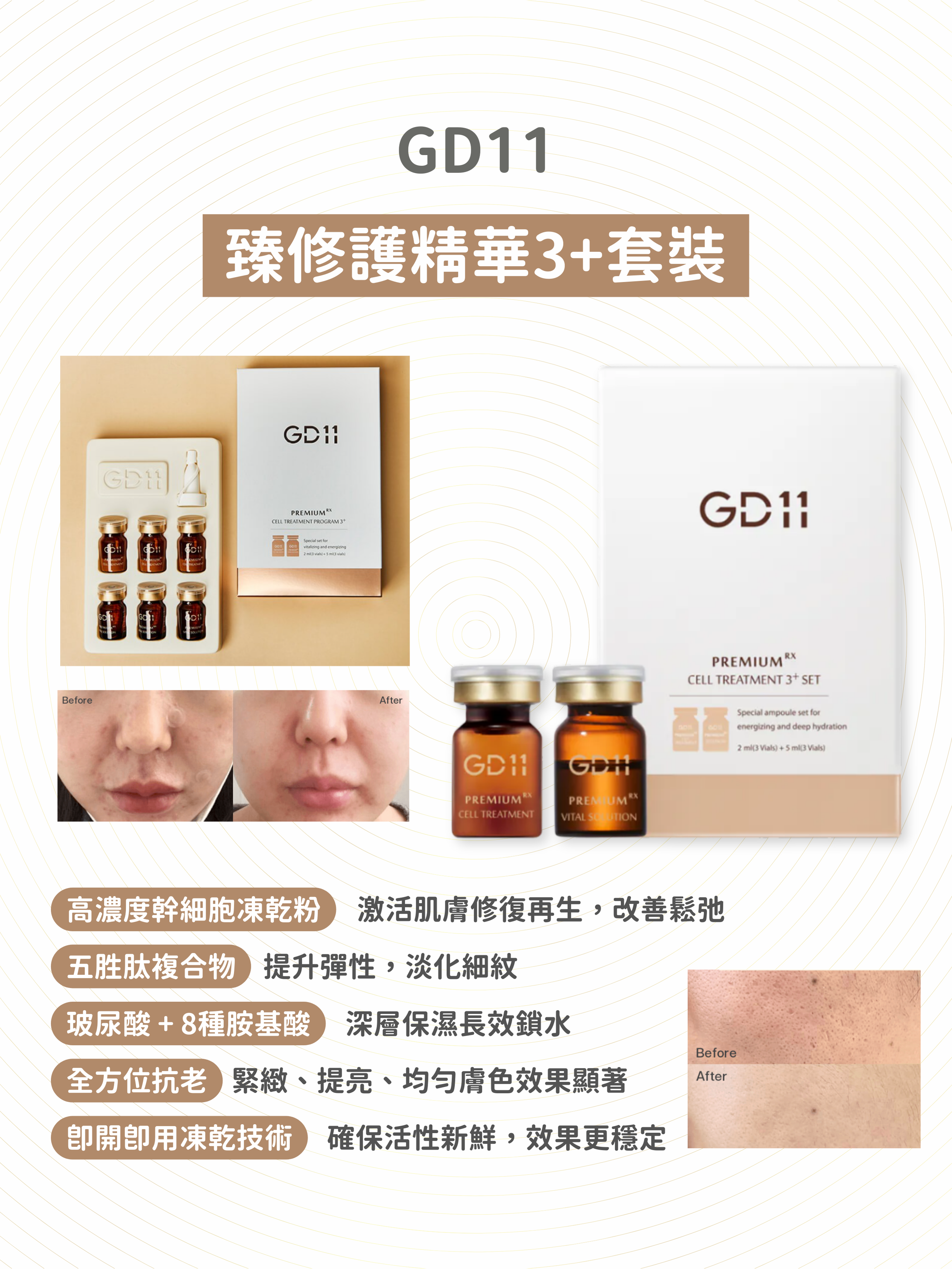 GD11 - 至臻修護精華3+套裝