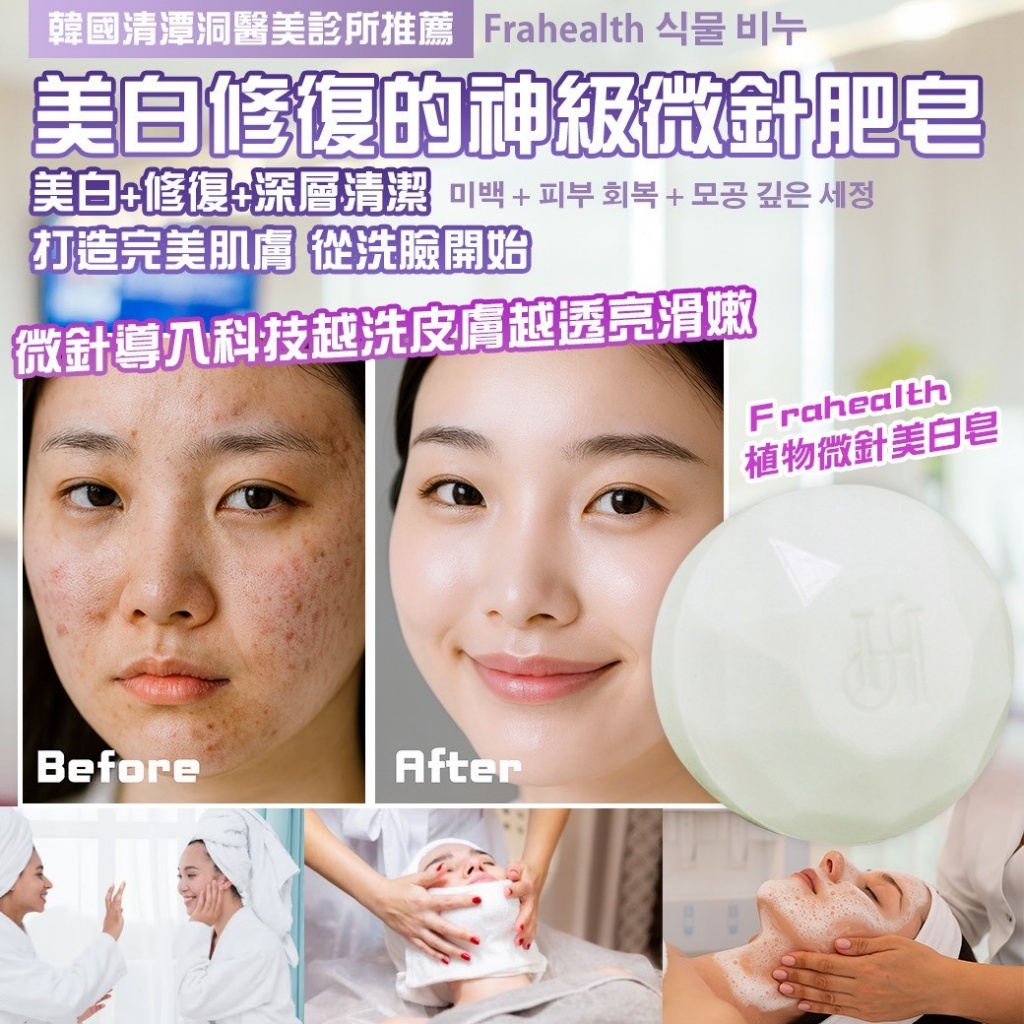 韓國製造 Frahealth ＋PDRN 再生亮白微針皂(買一送一/組)