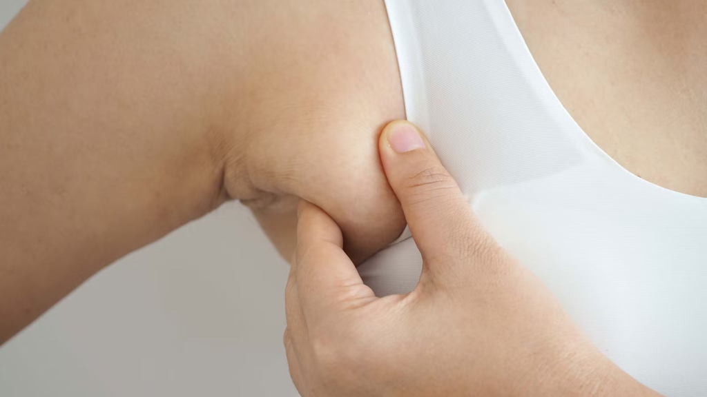 副乳怎麼消