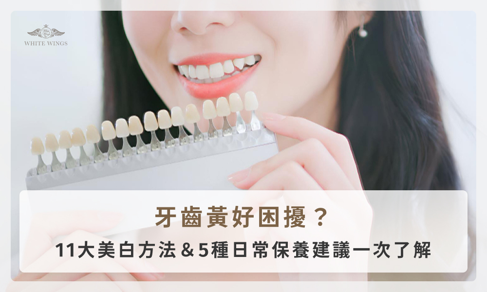 牙齒黃好困擾？11大美白方法＆5種日常保養建議一次了解