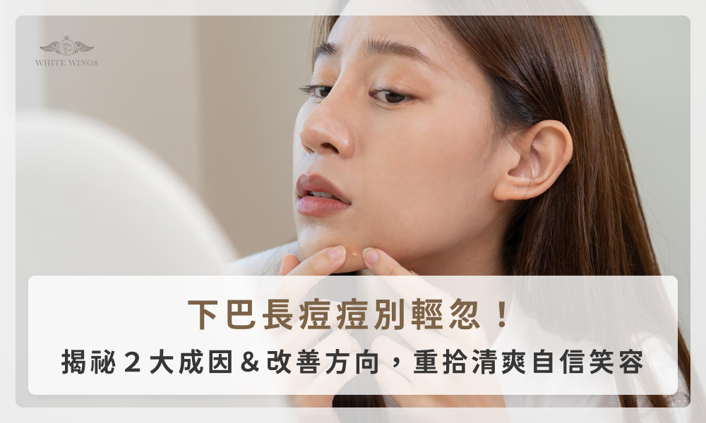 下巴長痘痘別輕忽！揭祕2大成因＆改善方向，重拾清爽自信笑容