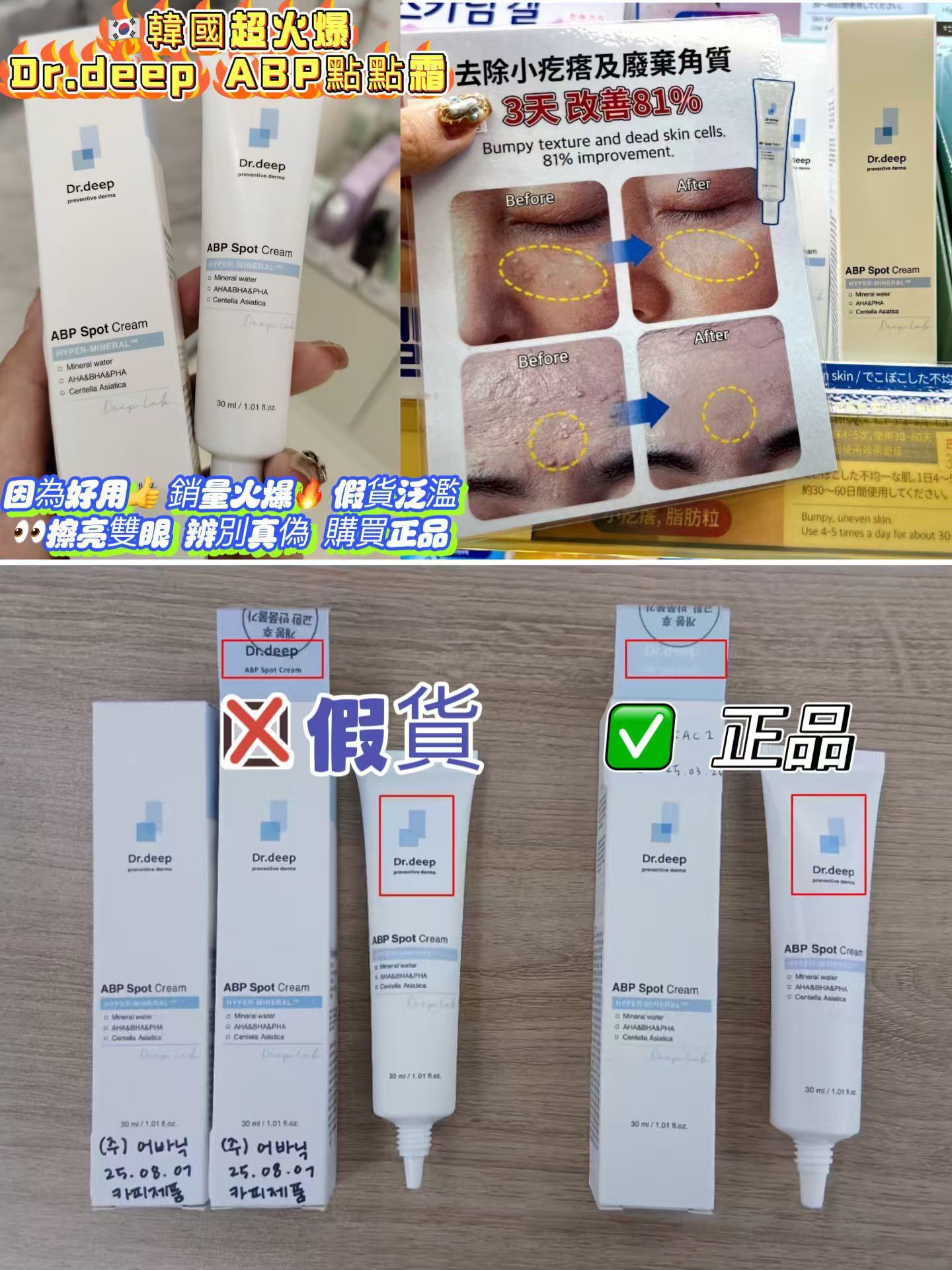 (限量30件) UC50 DR.Deep ABP 點點霜 30ML $388買一送一 made in Korea (EXP: 2028/06/19)