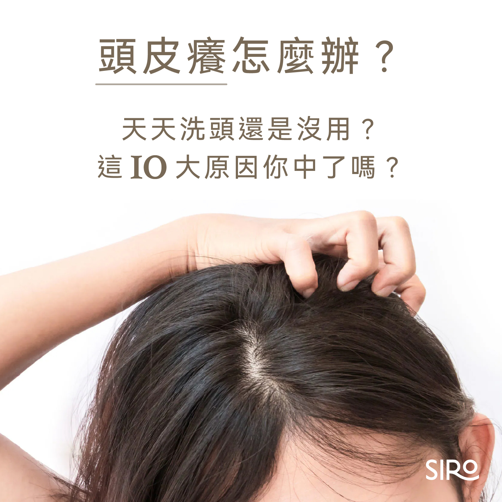 頭皮癢怎麼辦？天天洗頭還是沒用？這10大原因你中了嗎？