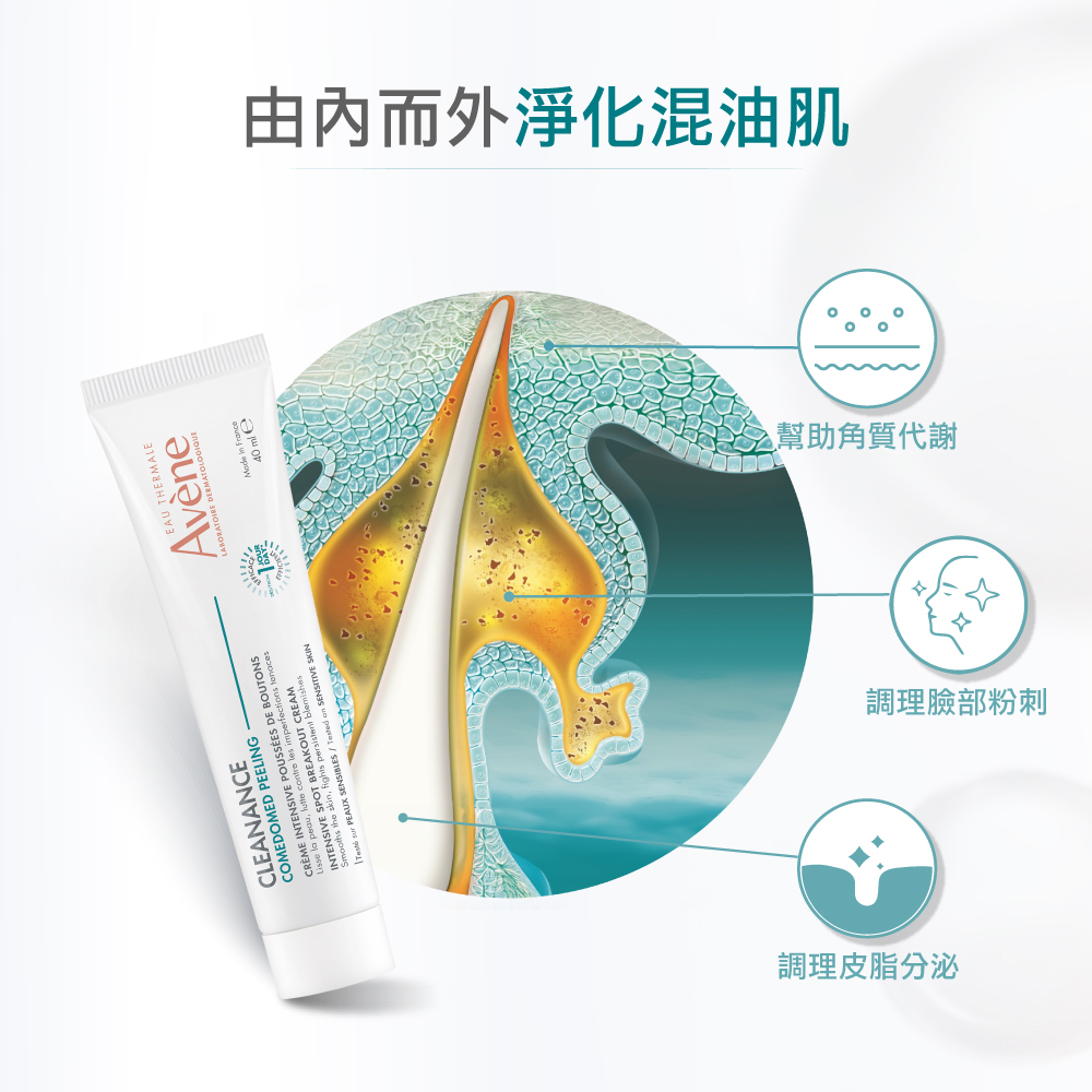 Avene雅漾A醛速效淨痘精華 控油抗痘 減少粉刺 黑頭