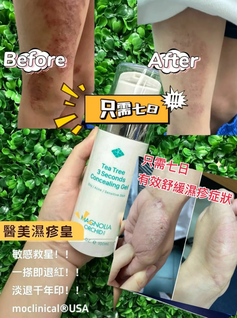 【直播】Moclinical LL091623 醫美濕疹皇再新細胞凝膠