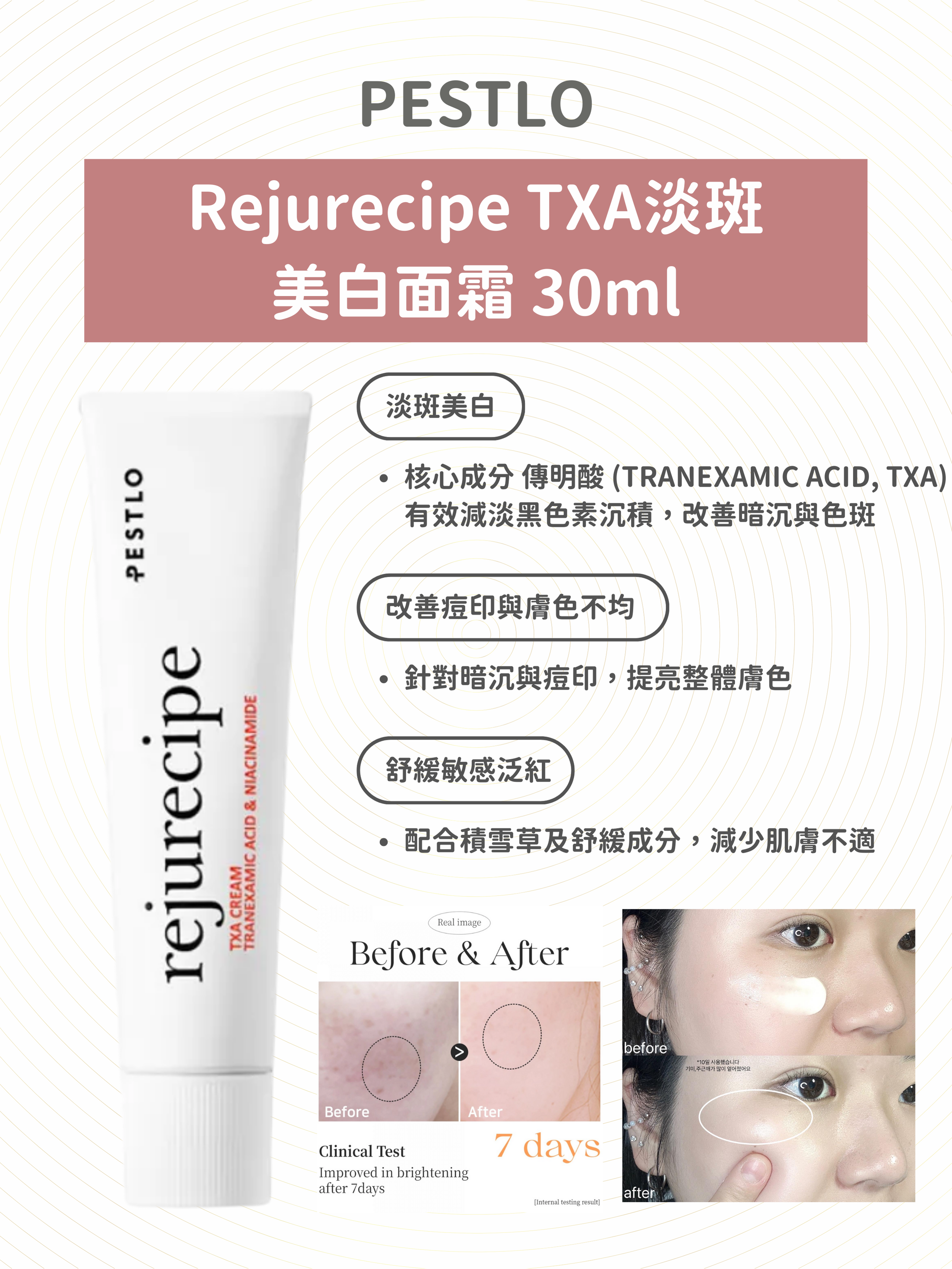 (到期日: 09/2026) PESTLO - Rejurecipe TXA淡斑美白面霜 30ml